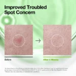 تونر أنوا أزيليك أسيد 3% سيكا 250 مل | تهدئة البشرة وتنقية المسام