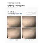 سيروم تقليل المسام وتنقية البشرة من ميديكوب للعناية اليومية 30مل (2)