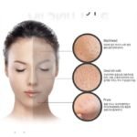 قناع فقاعات الأكسجين لتنظيف البشرة بعمق وتنقية المسام من بيورديرم 1 قناع